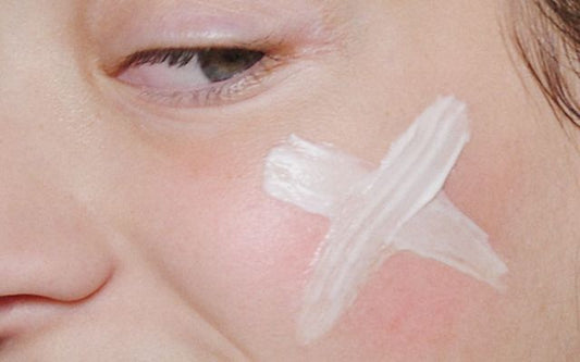 what is the skin barrier – and why does it matter