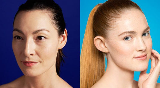 The difference between adult acne and teen acne - Dermalogica Thailand