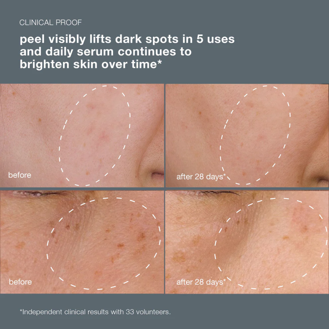 powerbright dark spot system (2 full-size)