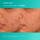 Dermalogica Breakout Biotic Moisturizer 6ml Trial Size