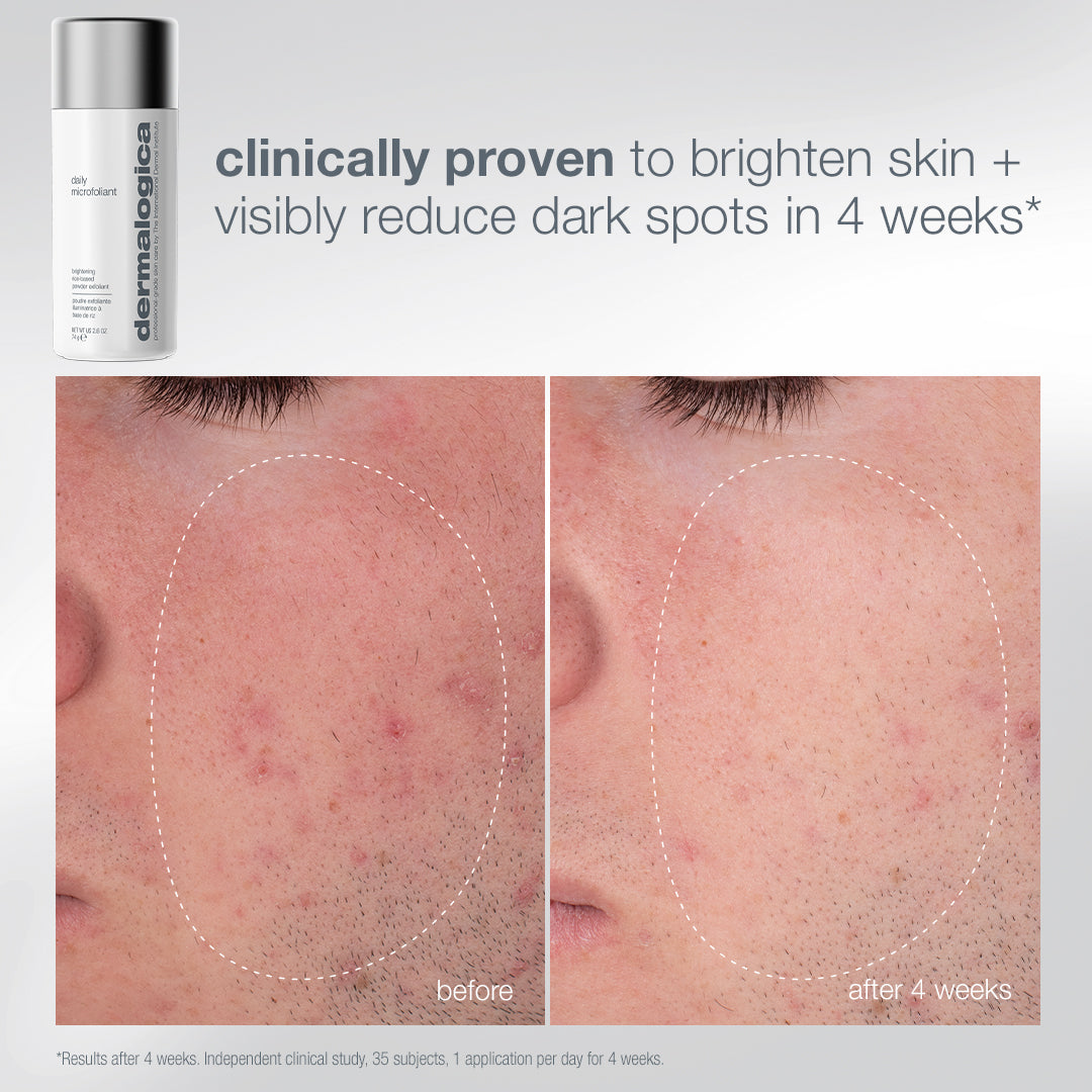 pro ritual: exfoliate + glow set (limited-edition full-size + 2 pro tools)