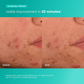 breakout biotic moisturizer