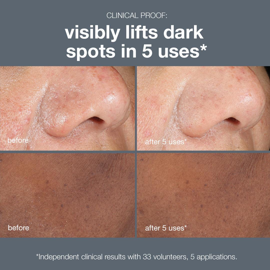 powerbright dark spot peel