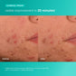 Dermalogica Breakout Biotic Moisturizer 6ml Trial Size