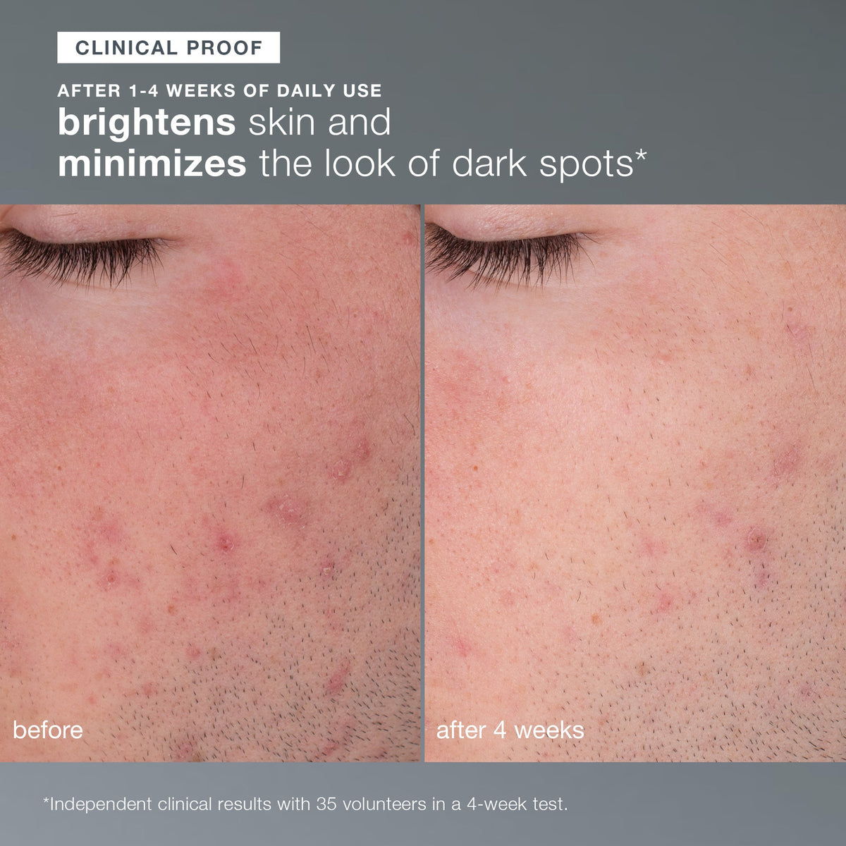 daily microfoliant