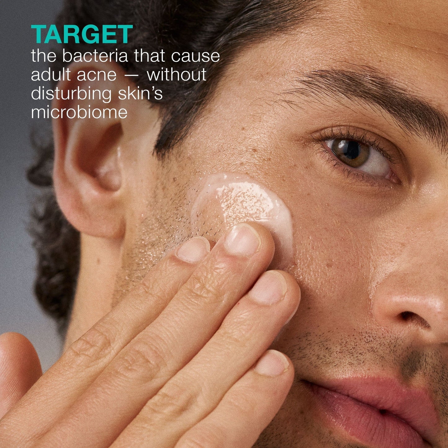 Dermalogica Breakout Biotic Moisturizer 6ml Trial Size