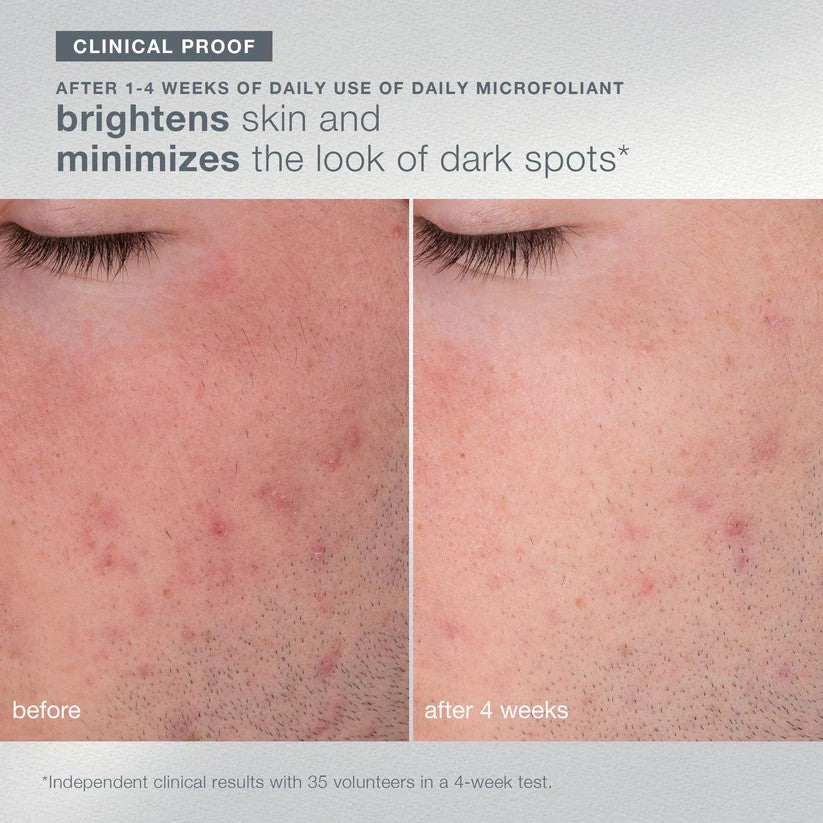 [Exclusive Set] daily microfoliant 74 g + travel size 13g