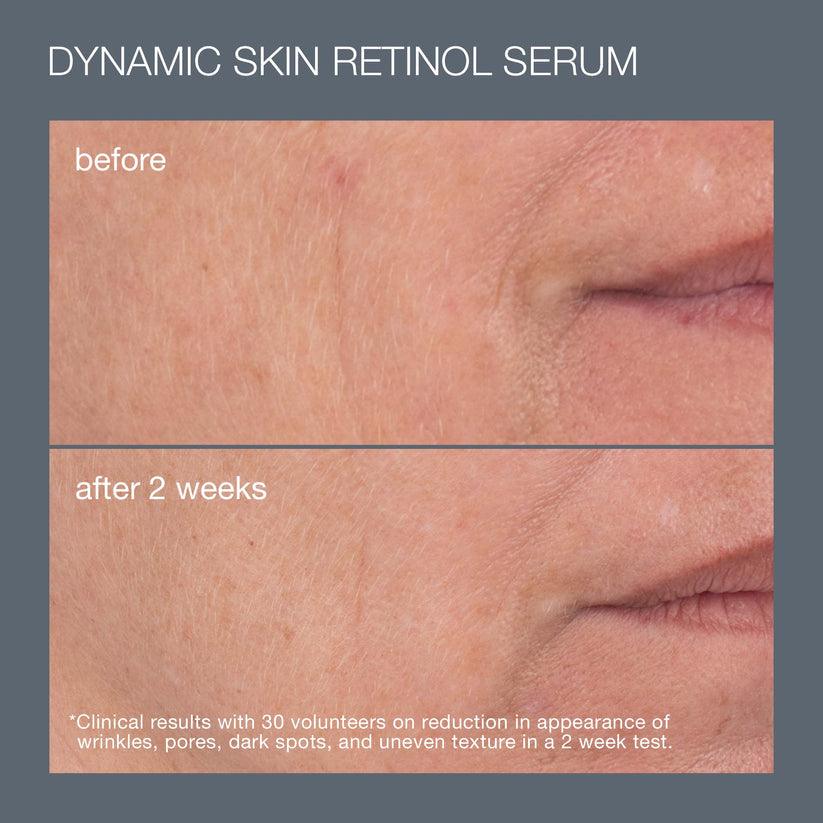 skin aging solutions set (2 full-size best sellers) - Dermalogica Thailand