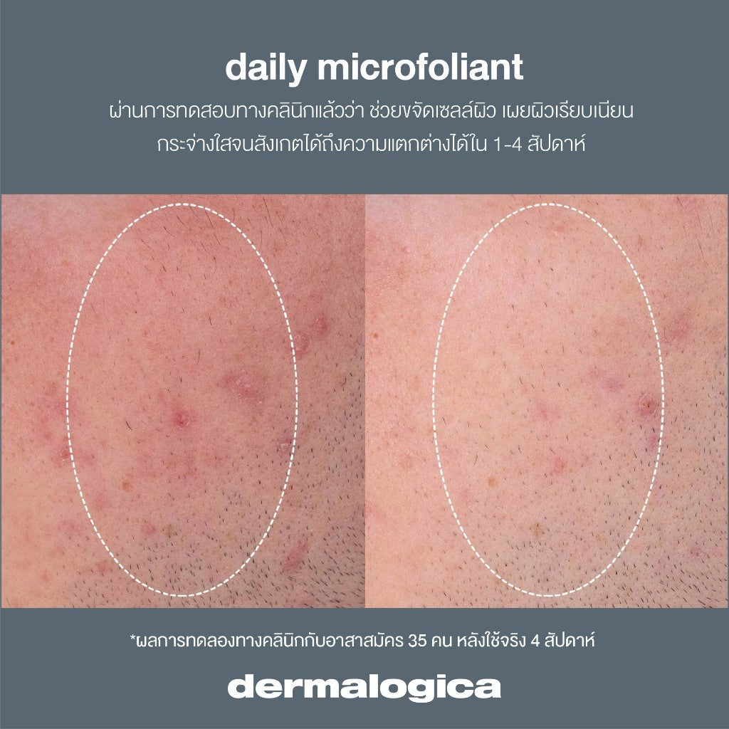 Daily Microfoliant 13g + Special Cleansing Gel 50 ml + Precleanse 50 ml Free puffy bag